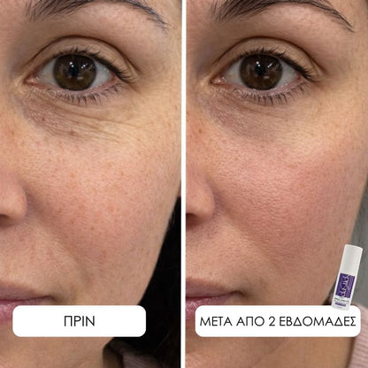 Elastick - Calcium Multi Balm Stick