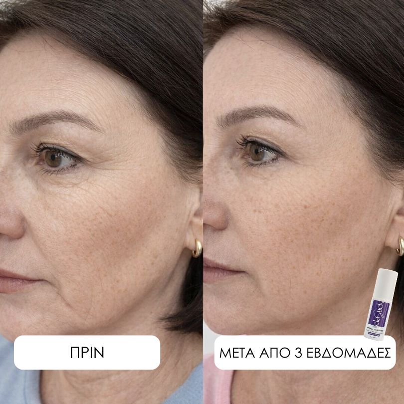 Elastick - Calcium Multi Balm Stick