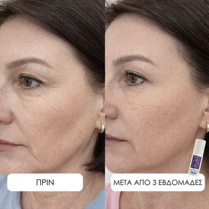 Elastick - Calcium Multi Balm Stick