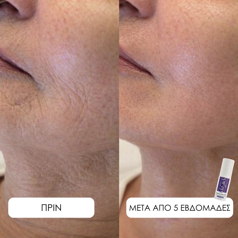 Elastick - Calcium Multi Balm Stick