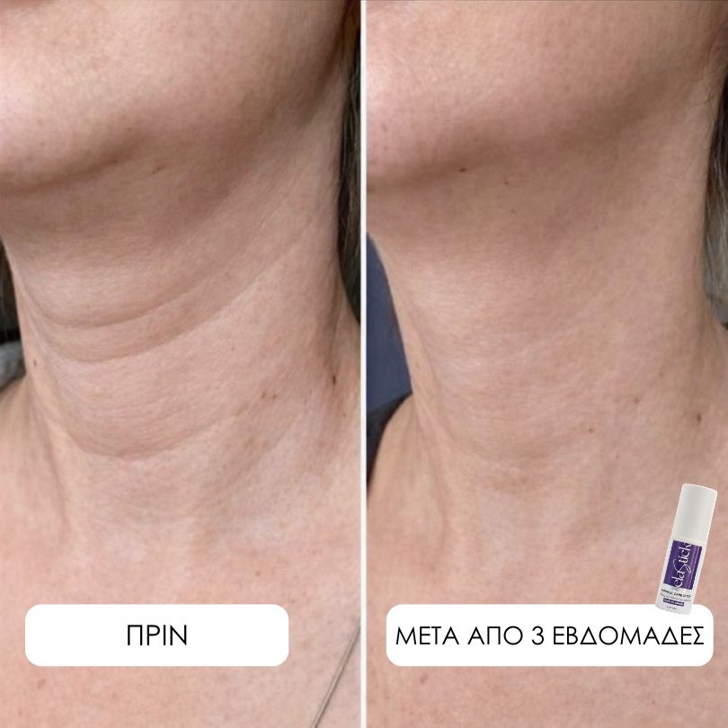 Elastick - Calcium Multi Balm Stick