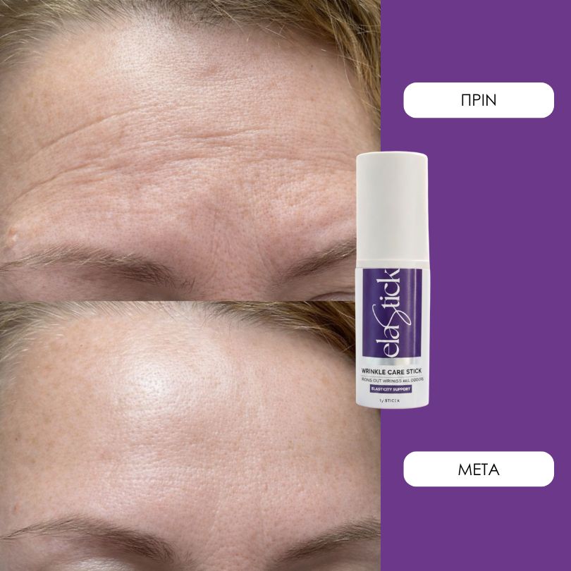 Elastick - Calcium Multi Balm Stick