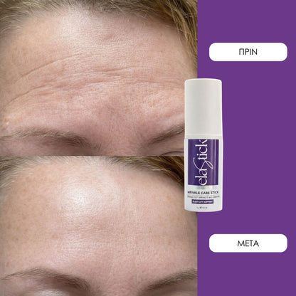 Elastick - Calcium Multi Balm Stick