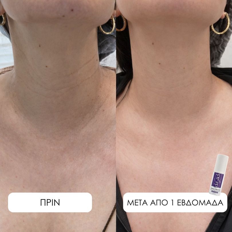 Elastick - Calcium Multi Balm Stick