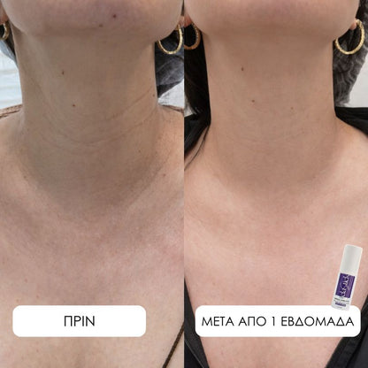 Elastick - Calcium Multi Balm Stick