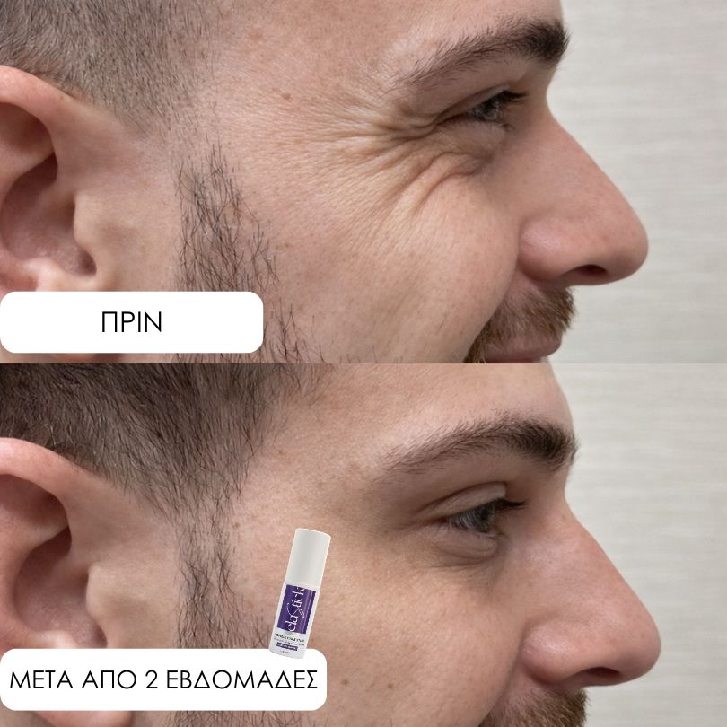 Elastick - Calcium Multi Balm Stick